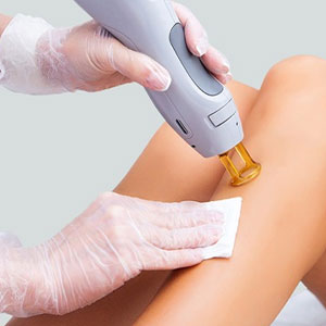 Laser Hair Removal Hyderabad